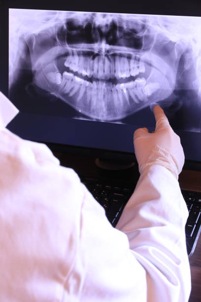 Best Dental Abscess Treatment in Rogers, TX