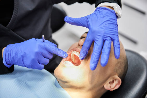 Best Broken or Chipped Tooth Repair in Rogers, TX